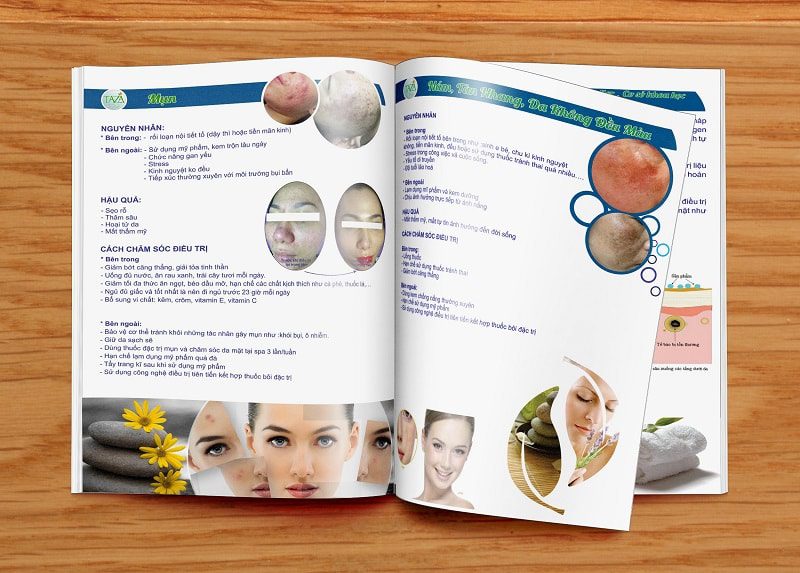 Mẫu catalogue spa đẹp